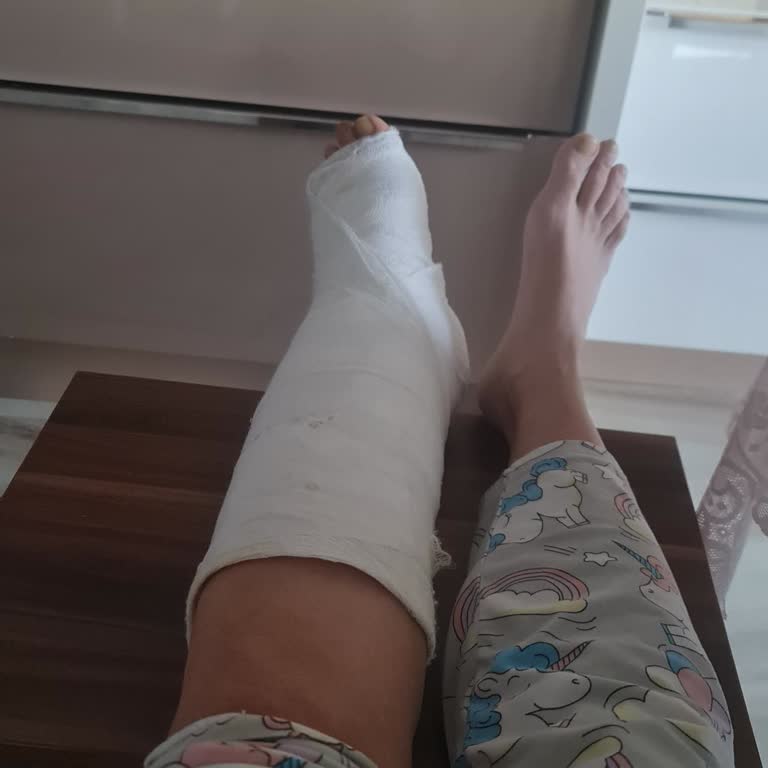 Calvin Klein Ayakkabı Yüzünden Ayağım Kırıldı