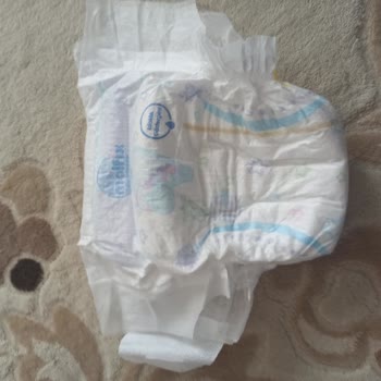 Molfix Bebek Bezi Defolu: Mağduriyetin Giderilmesini Bekliyoruz