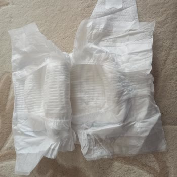 Molfix Bebek Bezi Defolu: Mağduriyetin Giderilmesini Bekliyoruz