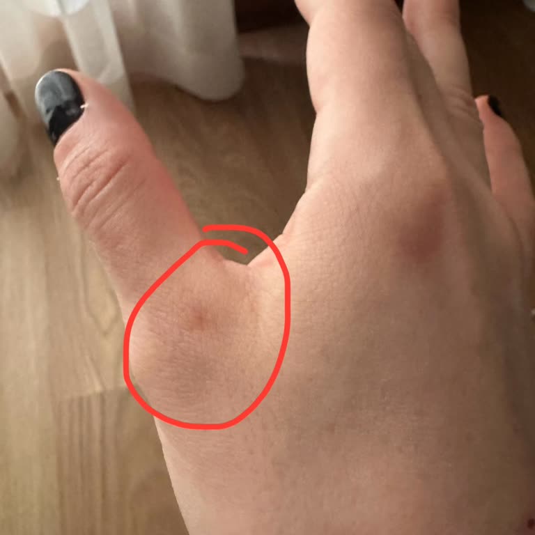 Arnica Solera Dikey Süpürge: Isınma Ve Elektrik Kaçağı Sorunları