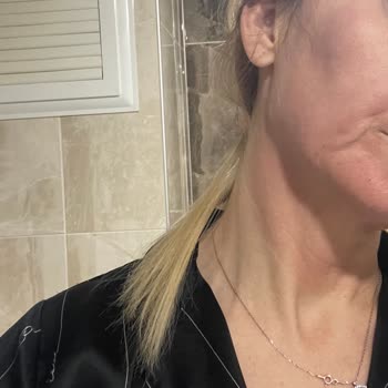 Cilt Serumu Sonrası Ciddi Alerjik Reaksiyon Ve İletişim Sorunları