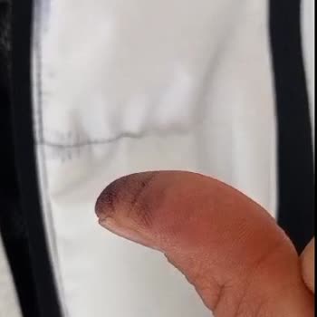 Montun Fermuar Sorunu Ve Müşteri Hizmetleri Hayal Kırıklığı