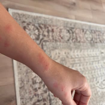 Tahtakurusu Sorunu: Enza Home Ürünüyle Gelen Kabus