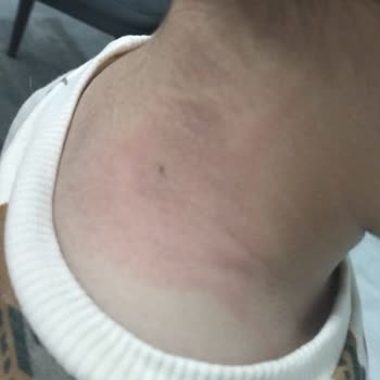 Patlayan Düdüklü Tencere Kabusu