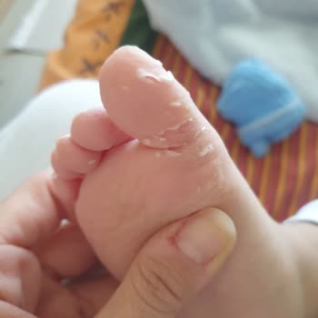 Çocuğumun Ayaklarını Mahveden Botlar!