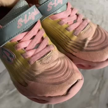 Skechers Ayakkabılar 1 Ayda Patladı