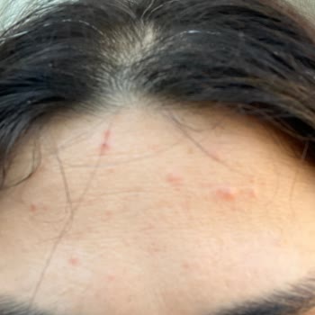 Cilt Sorunları Ve Para Kaybı: Flormar Fondöten Şikayeti