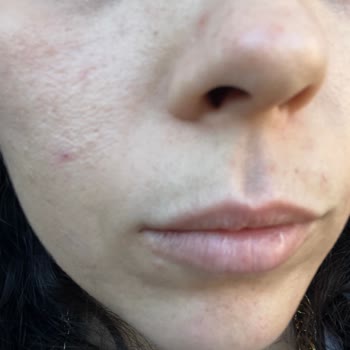 Cilt Sorunları Ve Para Kaybı: Flormar Fondöten Şikayeti