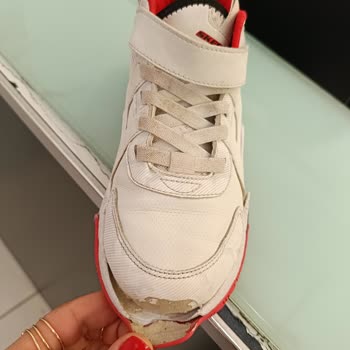 Skechers Ayakkabı 2 Ayda Darmadağın Oldu, Firma Sorumluluğu Kabul Etmiyor