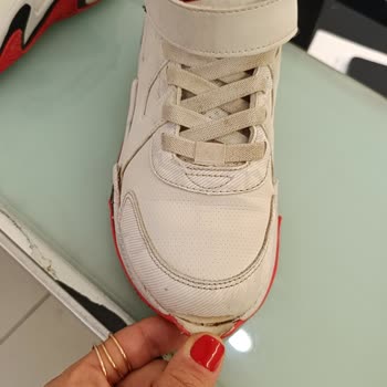 Skechers Ayakkabı 2 Ayda Darmadağın Oldu, Firma Sorumluluğu Kabul Etmiyor