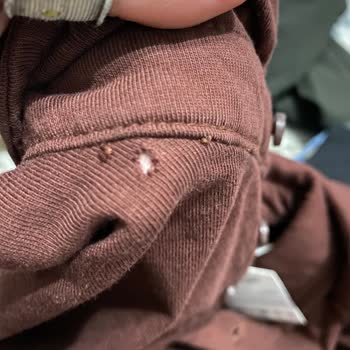 Zara İndiriminde Defolu Ürün Kabusu