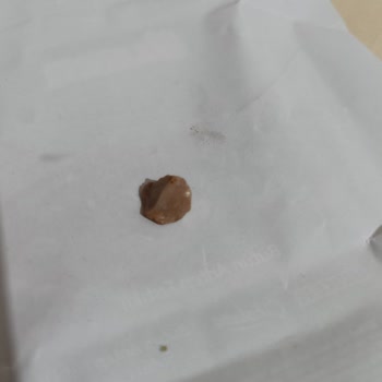 Ülker Çikolatanın İçinden Çıkan Taş Tehlikesi