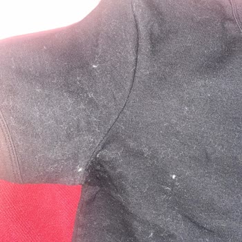 Koton Biker Montun Tüy Sorunu