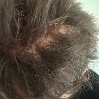 Saç Bakımında Hayal Kırıklığı