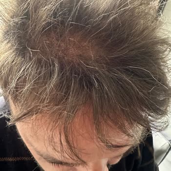 Saç Bakımında Hayal Kırıklığı