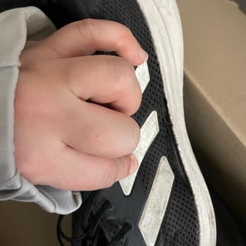 Adidas Ayakkabıda Erken Yıpranma Sorunu