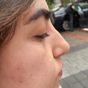 Rezan Pekdoğan Uzman Güvencesi Verdiler, Sonuç Hayal Kırıklığı!