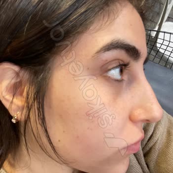 Rezan Pekdoğan Uzman Güvencesi Verdiler, Sonuç Hayal Kırıklığı!