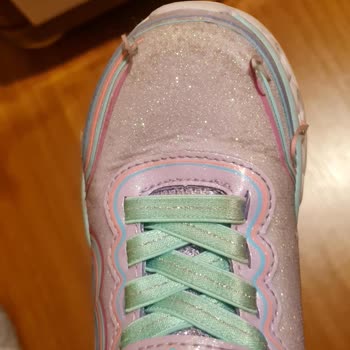 Skechers Çocuk Ayakkabısının Hızla Yıpranması