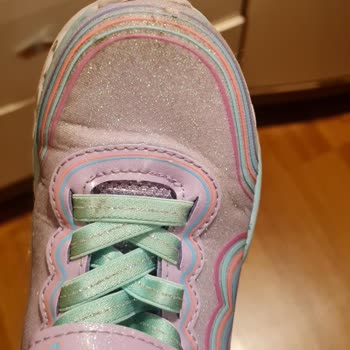 Skechers Çocuk Ayakkabısının Hızla Yıpranması