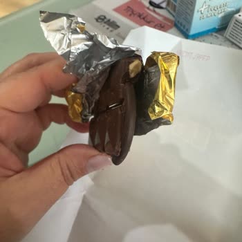 Eti Çikolata İçinden Çıkan Yabancı Cisim Ve İlgisizlik