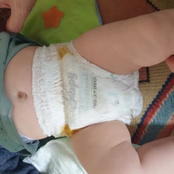Sleepy Külot Bez İle Sürekli Sızıntı Problemi