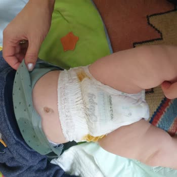 Sleepy Külot Bez İle Sürekli Sızıntı Problemi