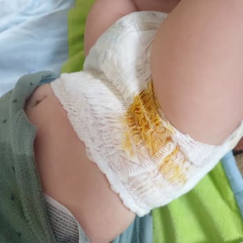 Sleepy Külot Bez İle Sürekli Sızıntı Problemi