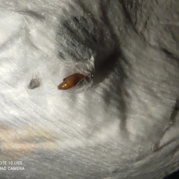 Sleepy Bebek Bezlerinden Çıkan Böcekler Güvenimizi Sarsıyor