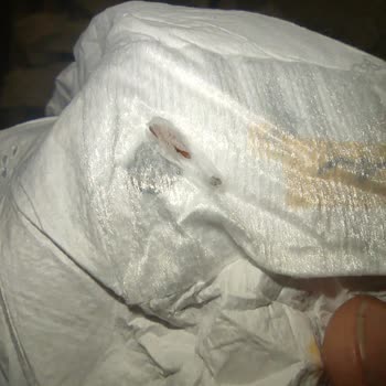 Sleepy Bebek Bezlerinden Çıkan Böcekler Güvenimizi Sarsıyor