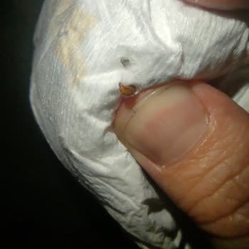 Sleepy Bebek Bezlerinden Çıkan Böcekler Güvenimizi Sarsıyor