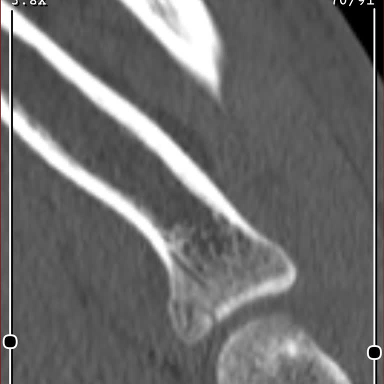 Samsung Galaxy Watch 5 Pro'nun Sert Düşme Modu Hayal Kırıklığı Yarattı