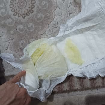 Sleepy Bebek Bezlerinde Kalite Düşüşü Ve Sağlık Sorunları