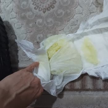 Sleepy Bebek Bezlerinde Kalite Düşüşü Ve Sağlık Sorunları