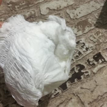 Sleepy Bebek Bezlerinde Yırtık Ve Kalite Sorunu