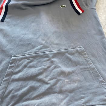 Vanish Kosla Oxi Action Toz Leke Çıkarıcı Kıyafetlerimi Mahvetti!