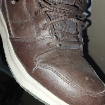 Skechers Botumun Beklenmedik Yırtılması Ve Destek Beklentisi