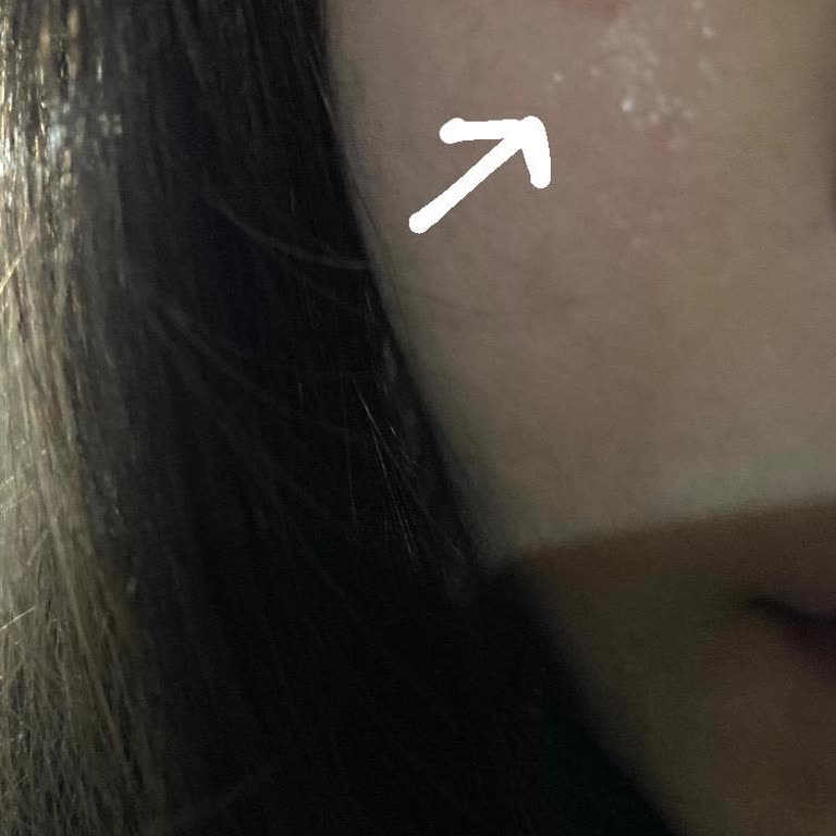 Cilt Yanığına Sebep Olan Ürün