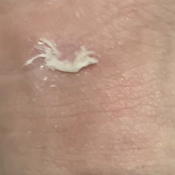 HM'den Aldığım Bot Ayağımı Yara Yaptı, Sorun Çözülmüyor