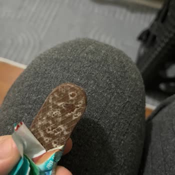 Xroll Çikolatasında Bozulma Ve Beyaz Lekeler