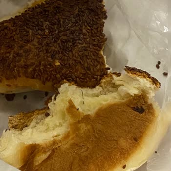 Poğaçanın İçinden İğne Çıktı!