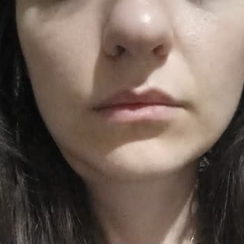 Macrol Antibiyotik Kullanımı Sonrası Sağlık Sorunları