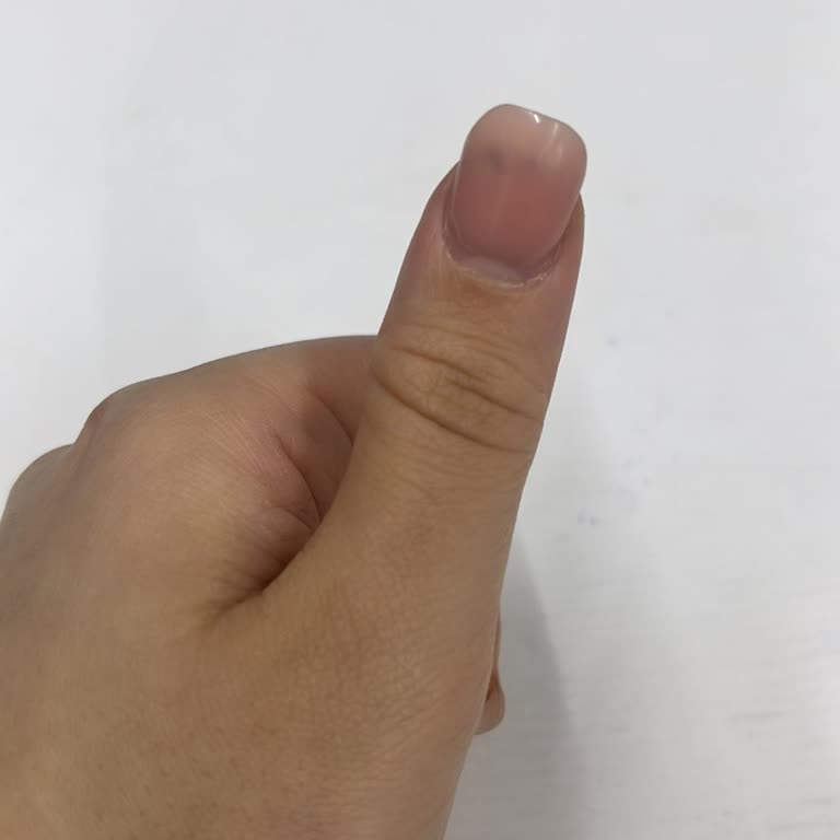Evlenme Teklifim İçin Hayal Kırıklığı: Tırnak Fiyaskosu