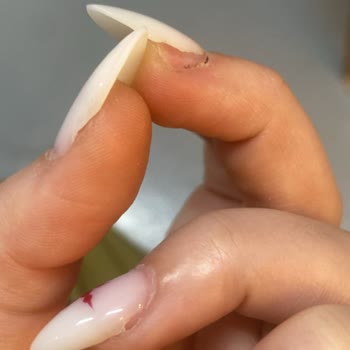 Protez Tırnakta Büyük Hayal Kırıklığı