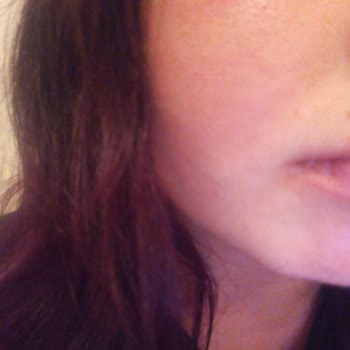 Nivea Revitalizing Cleanser Caused Severe Burning and Redness