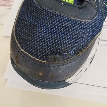 Skechers Ayakkabıda Hızlı Deformasyon Ve Müşteri Memnuniyetsizliği