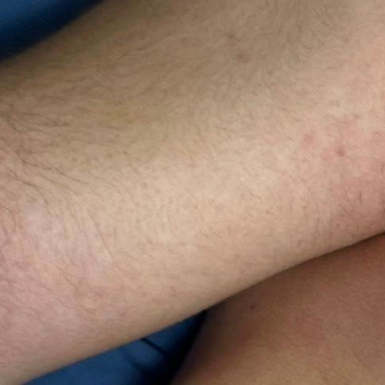 Alerji Testi Güven Vermiyor: Yanıltıcı Sonuçlar Ve İlgisiz Hizmet