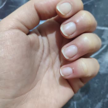 Aymira Koçaklı Yaşam Merkezi Zorla İş Yapan Saygısız Çalışan Görmek İstemiyorum