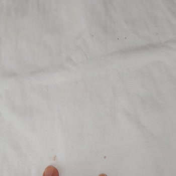 Electrolux Çamaşır Makinesi Lekeleri Ve İlgisiz Müşteri Hizmetleri
