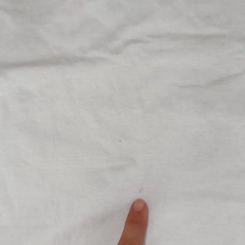 Electrolux Çamaşır Makinesi Lekeleri Ve İlgisiz Müşteri Hizmetleri